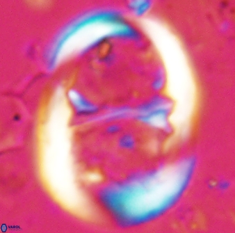 Lophodolithus praenascens 23374