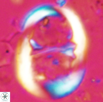Lophodolithus praenascens 23374
