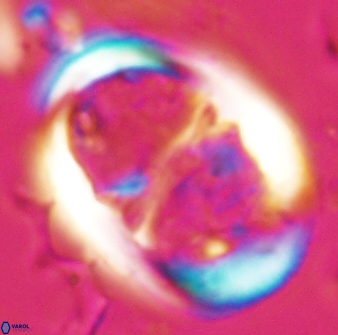 Lophodolithus praenascens 23375