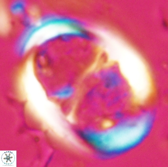 Lophodolithus praenascens 23375