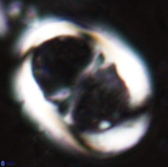 Lophodolithus praenascens 23376