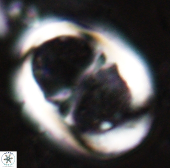 Lophodolithus praenascens 23376