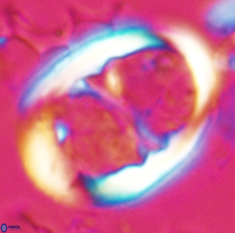 Lophodolithus praenascens 23378