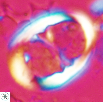 Lophodolithus praenascens 23378