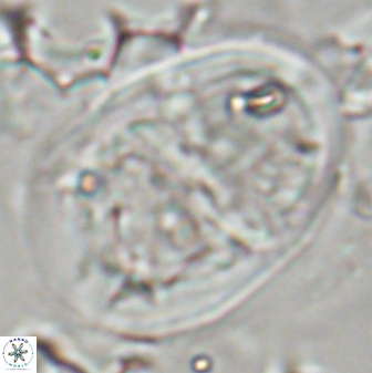 Lophodolithus praenascens 23379