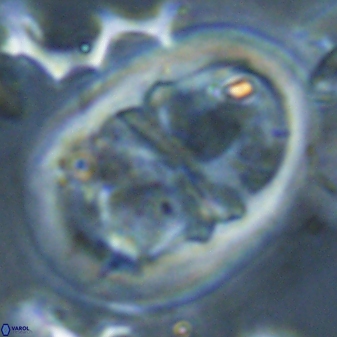 Lophodolithus praenascens 23380