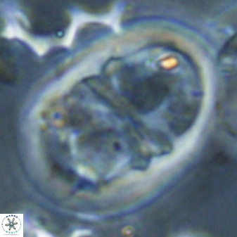 Lophodolithus praenascens 23380