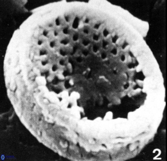 Crepidolithus perforatus 10991