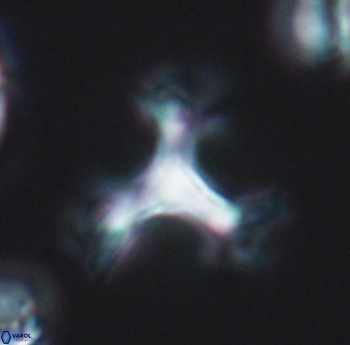 Marthasterites furcatus 11823