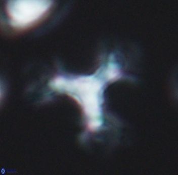 Marthasterites furcatus 11827