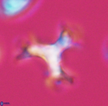 Marthasterites furcatus 11828