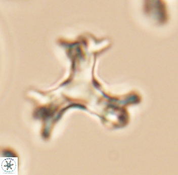 Marthasterites furcatus 11830
