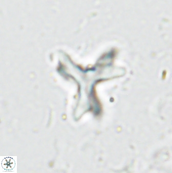 Marthasterites furcatus 33975