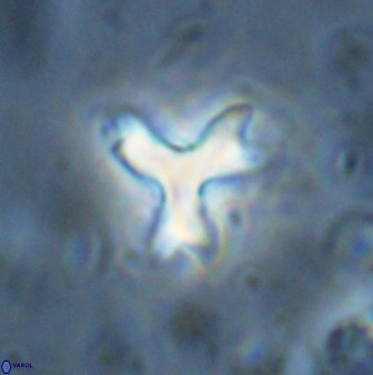 Marthasterites furcatus 33976