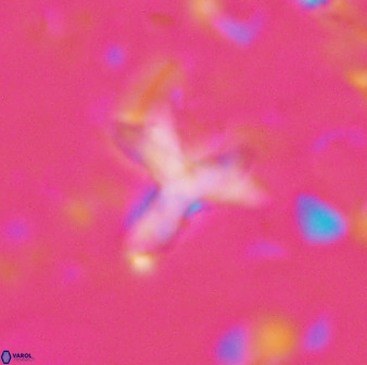 Marthasterites furcatus 33981