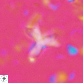 Marthasterites furcatus 33981