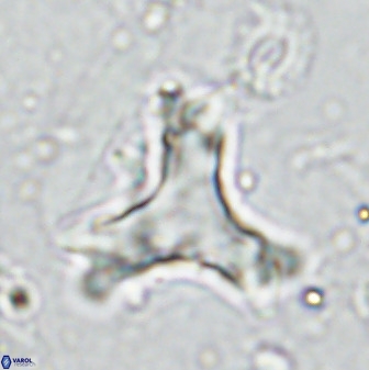 Marthasterites furcatus 33999