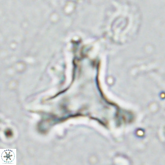Marthasterites furcatus 33999