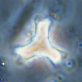 Marthasterites furcatus 34000