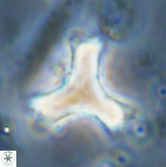 Marthasterites furcatus 34000