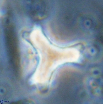 Marthasterites furcatus 34001