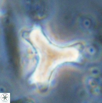 Marthasterites furcatus 34001