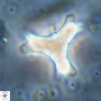 Marthasterites furcatus 34002