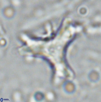Marthasterites furcatus 34003