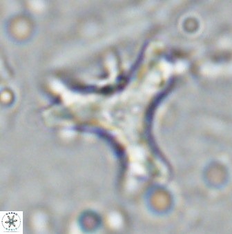 Marthasterites furcatus 34003