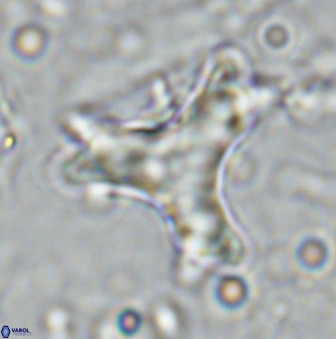 Marthasterites furcatus 34004