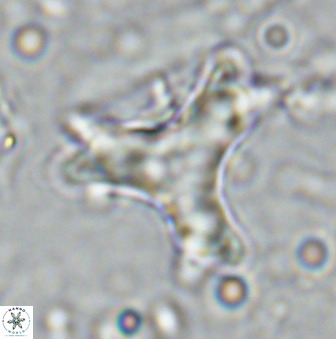 Marthasterites furcatus 34004