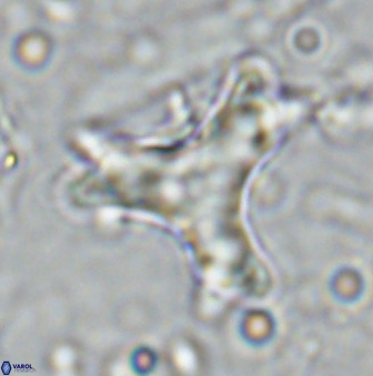 Marthasterites furcatus 34005