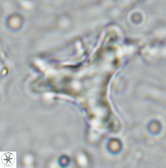 Marthasterites furcatus 34005