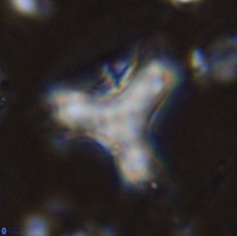 Marthasterites furcatus 34007