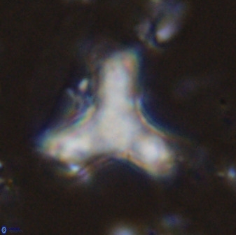 Marthasterites furcatus 34010