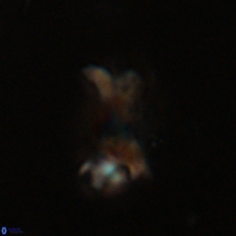 Marthasterites furcatus VR 22945