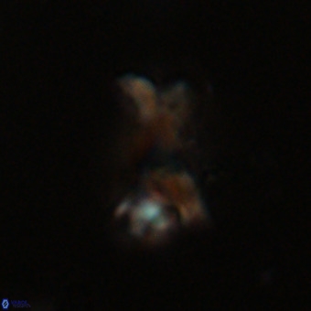Marthasterites furcatus VR 22946