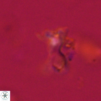 Marthasterites furcatus VR 22957