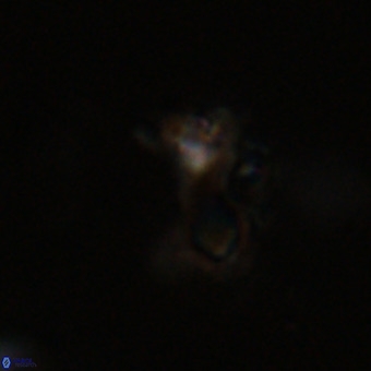 Marthasterites furcatus VR 22958