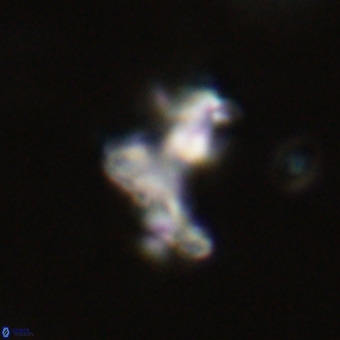 Marthasterites furcatus VR 22959