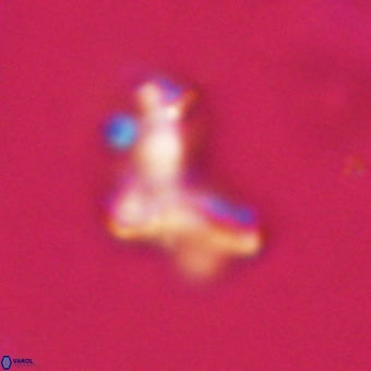 Marthasterites furcatus VR 22965