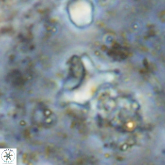 Marthesterites furcatus VR 20957