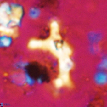 Marthesterites furcatus VR 20985