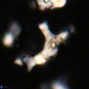 Marthesterites furcatus VR 20988