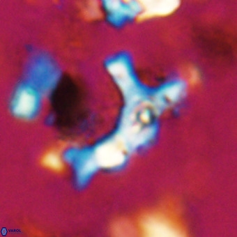 Marthesterites furcatus VR 20989