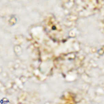 Marthesterites furcatus VR 21641