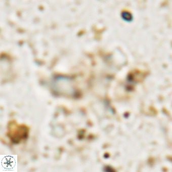 Marthesterites furcatus VR 21637