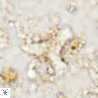 Marthesterites furcatus VR 21638