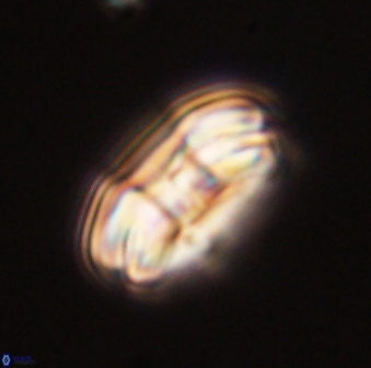Markalius astroporus 55568