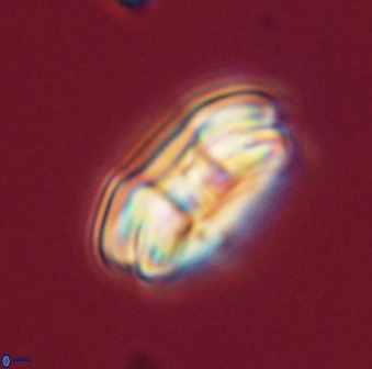 Markalius astroporus 55569